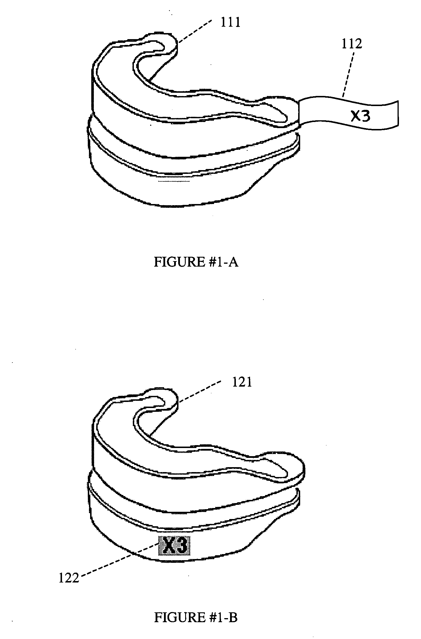 System and method for treatment of upper airway disorders