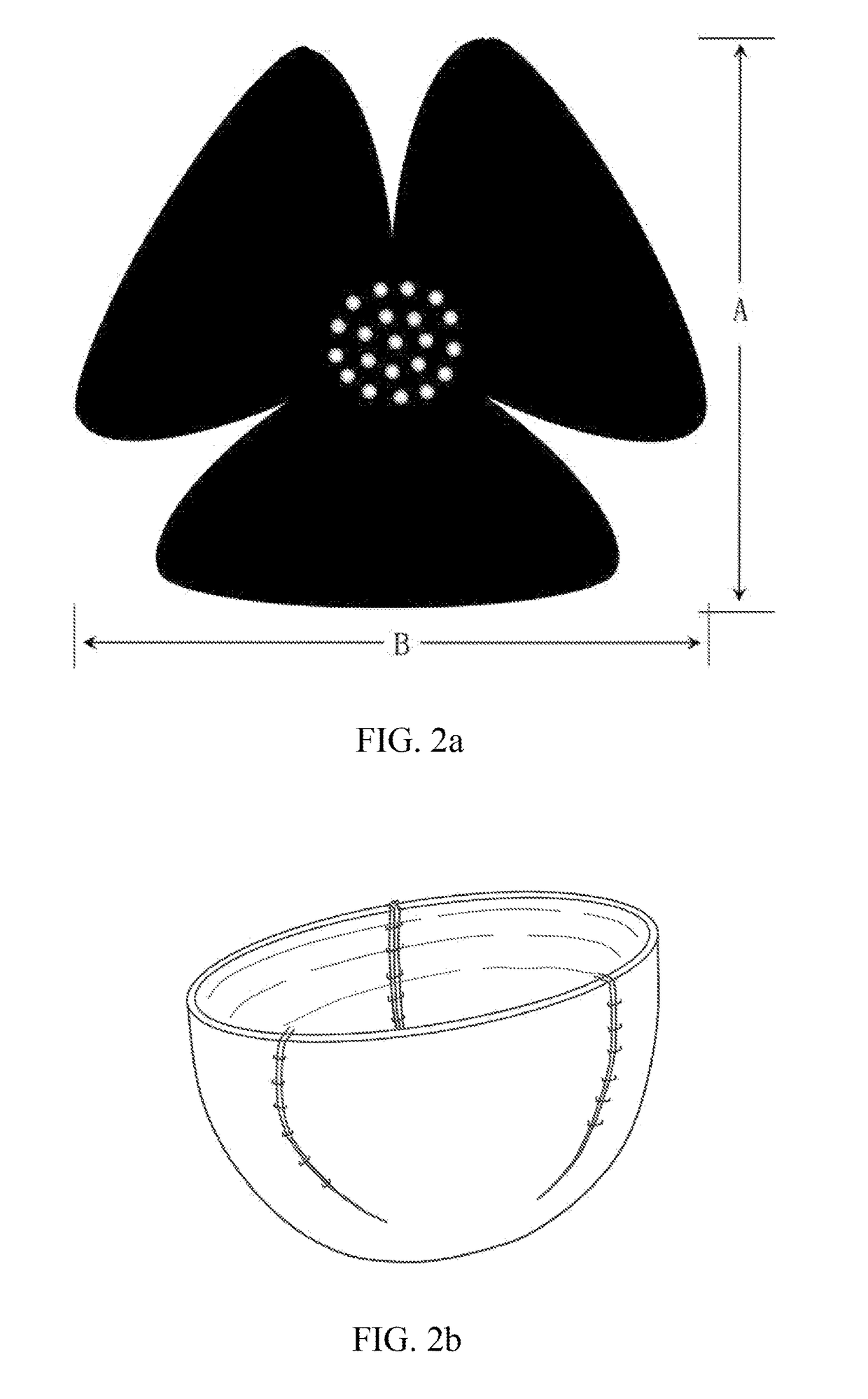 Breast prosthesis support device based on tissue matrix material, and preparation method therefor