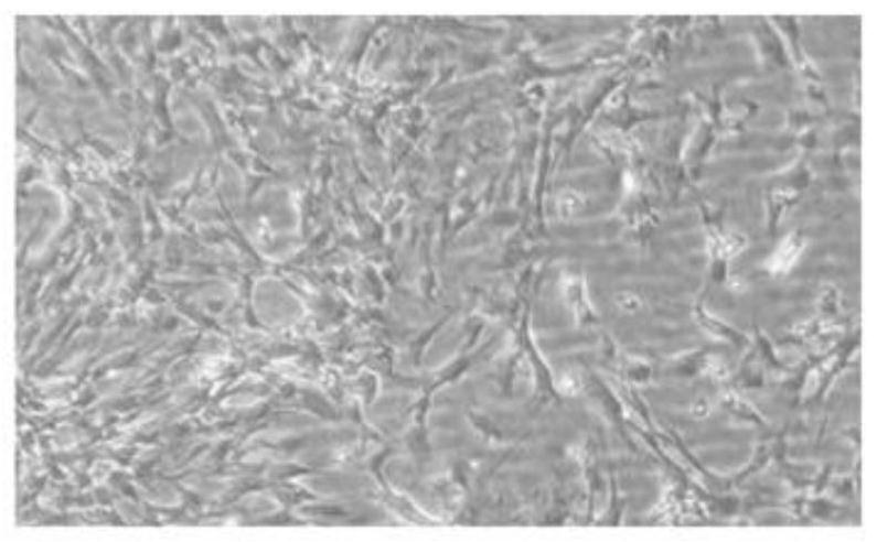Cell culture solution for enhancing cartilage differentiation induction, method and application