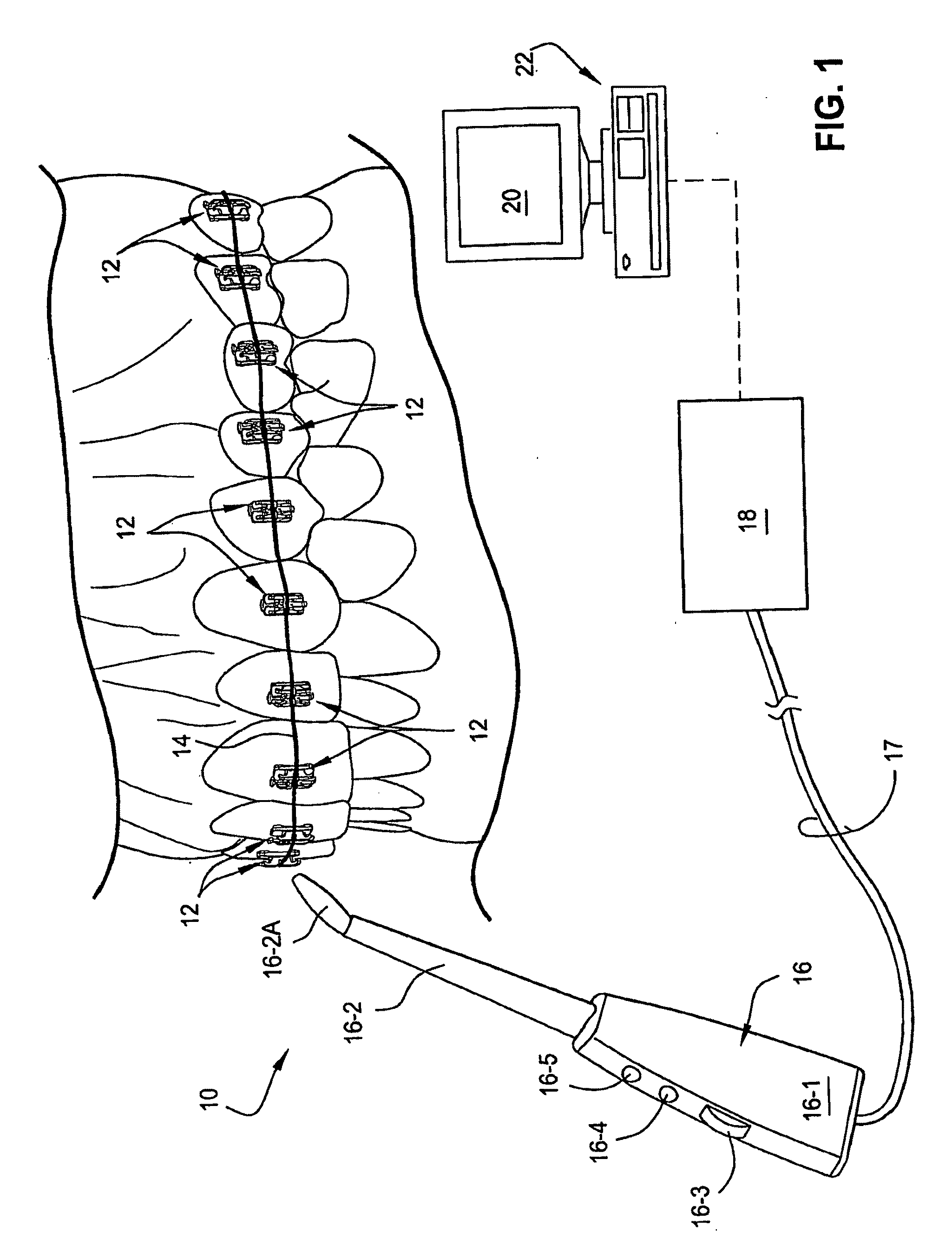 Method and System for Determining a Force and/or Torque Applied to an Orthodontic Bracket