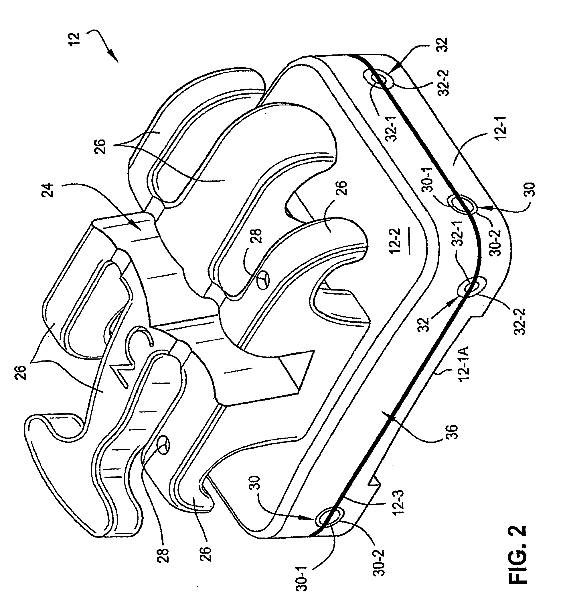 Method and System for Determining a Force and/or Torque Applied to an Orthodontic Bracket