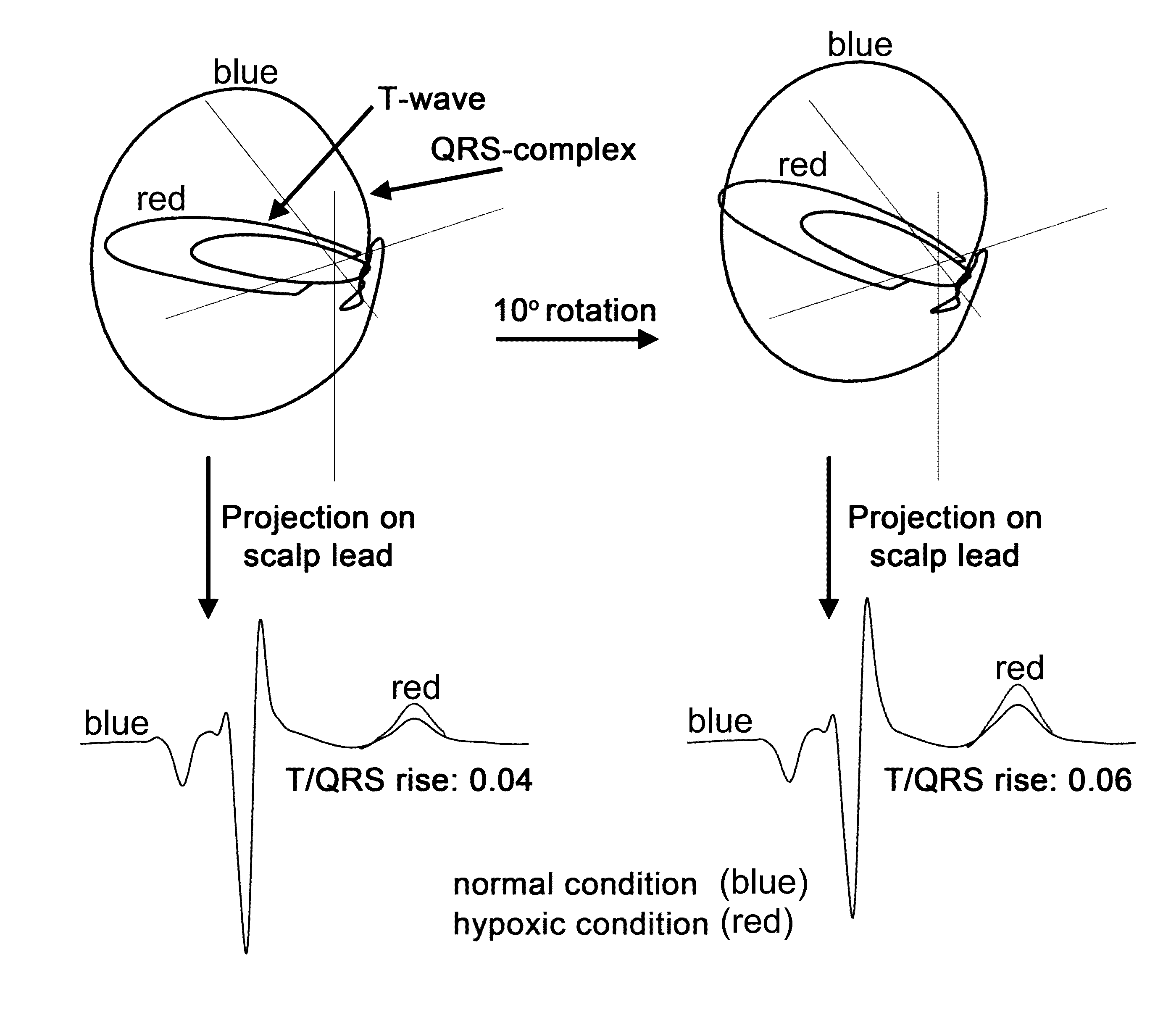 Fetal Cardiotocography Monitoring