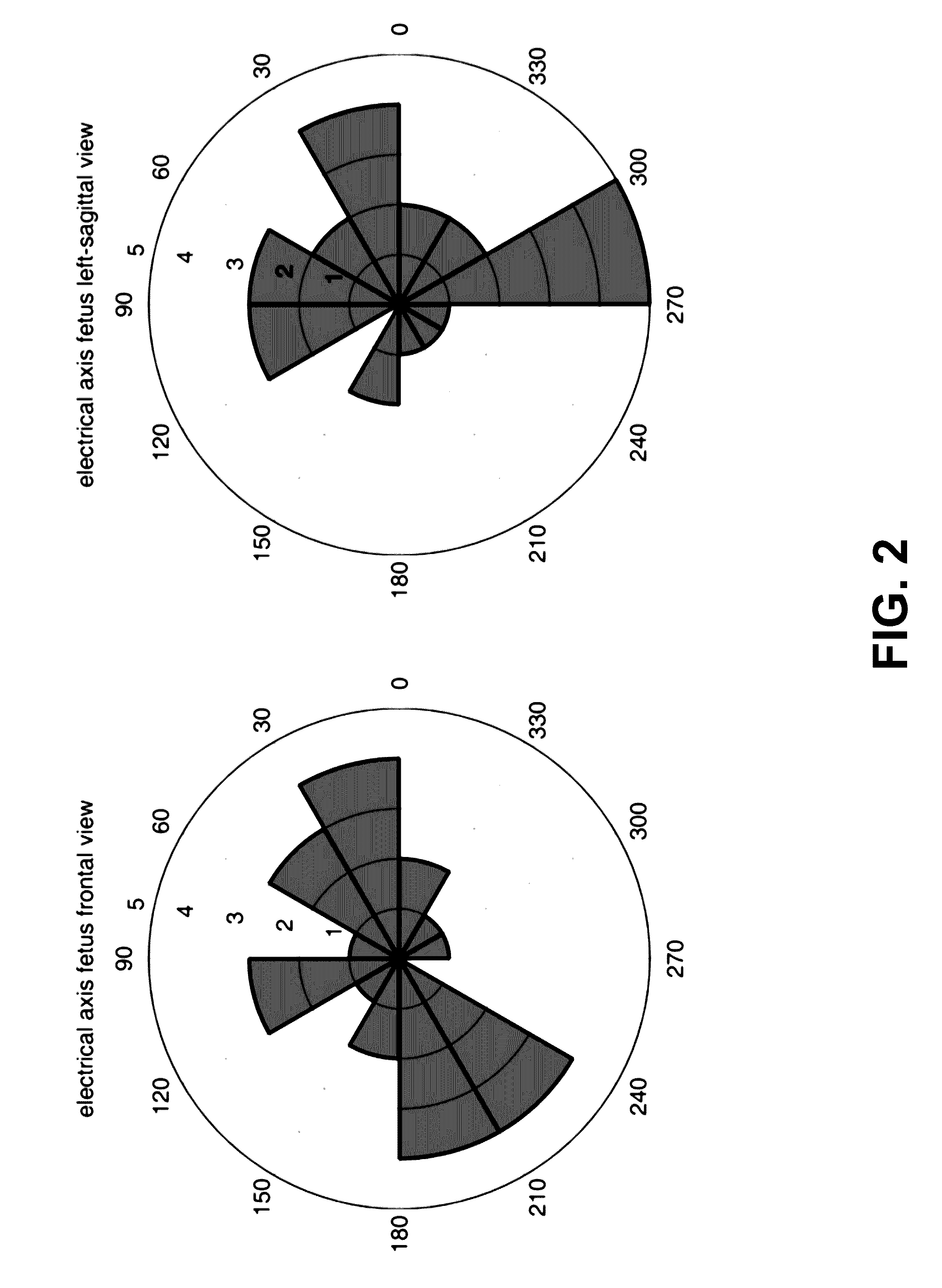 Fetal Cardiotocography Monitoring