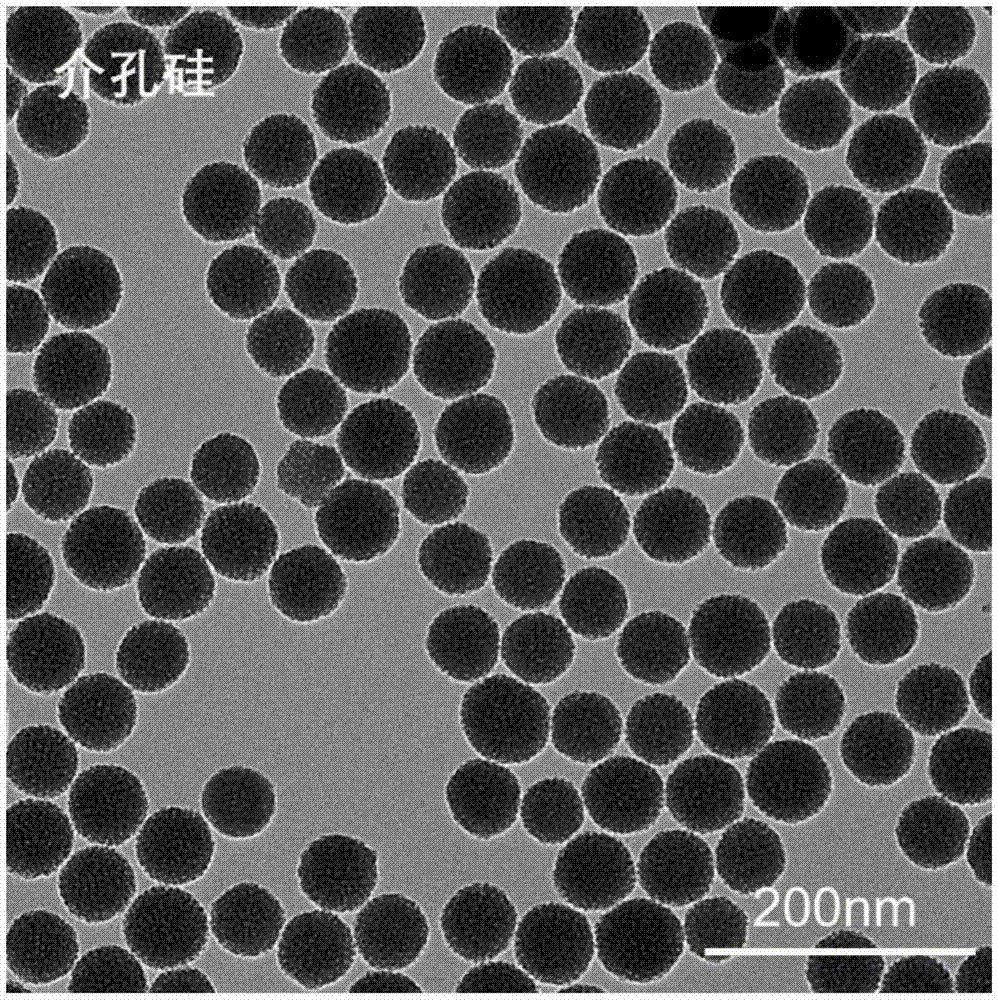 Cerium oxide/iron oxide/mesoporous silica nano composite material as well as preparation method and application thereof