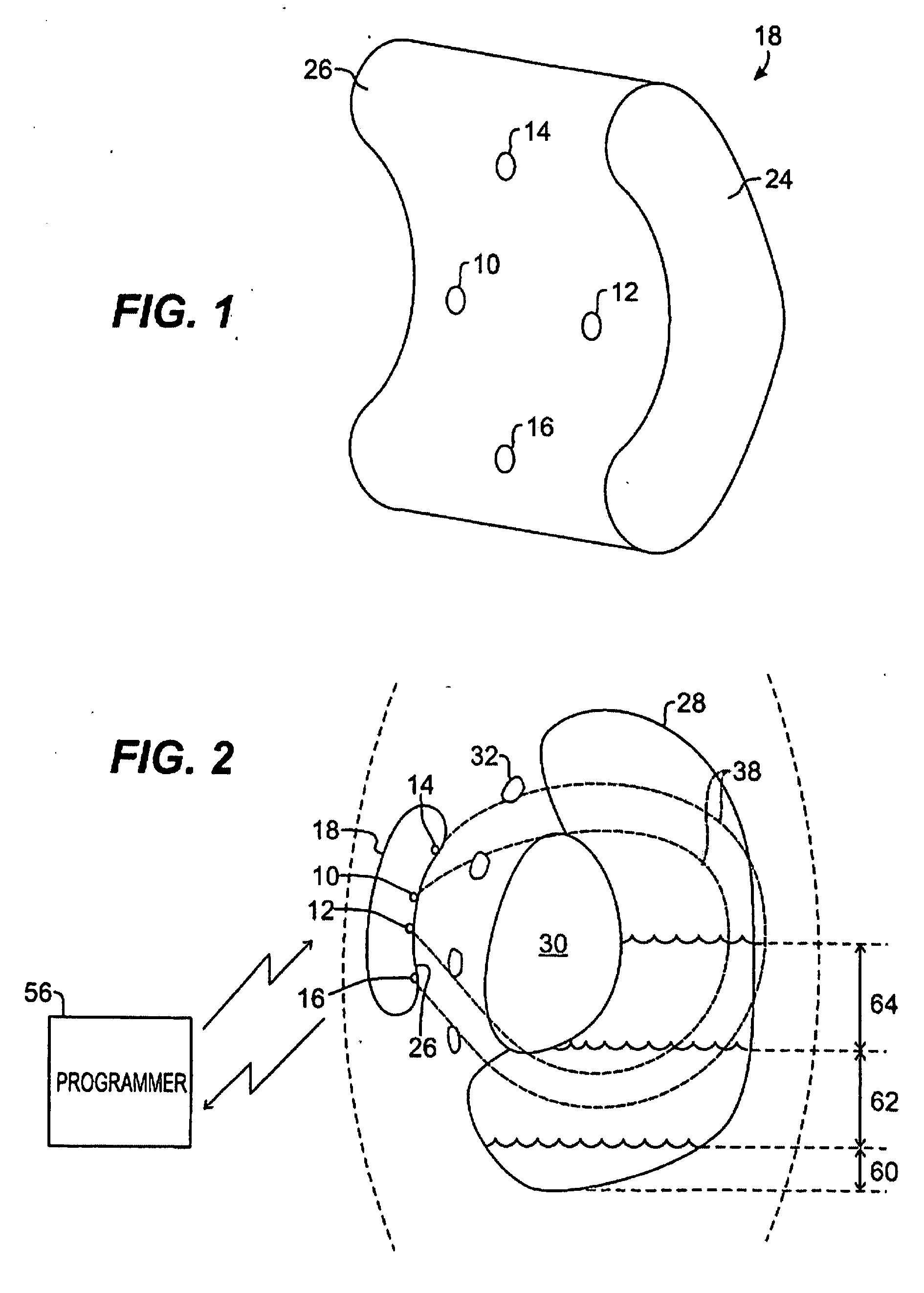 Remote Control of Implantable Device Through Medical Implant Communication Service Band