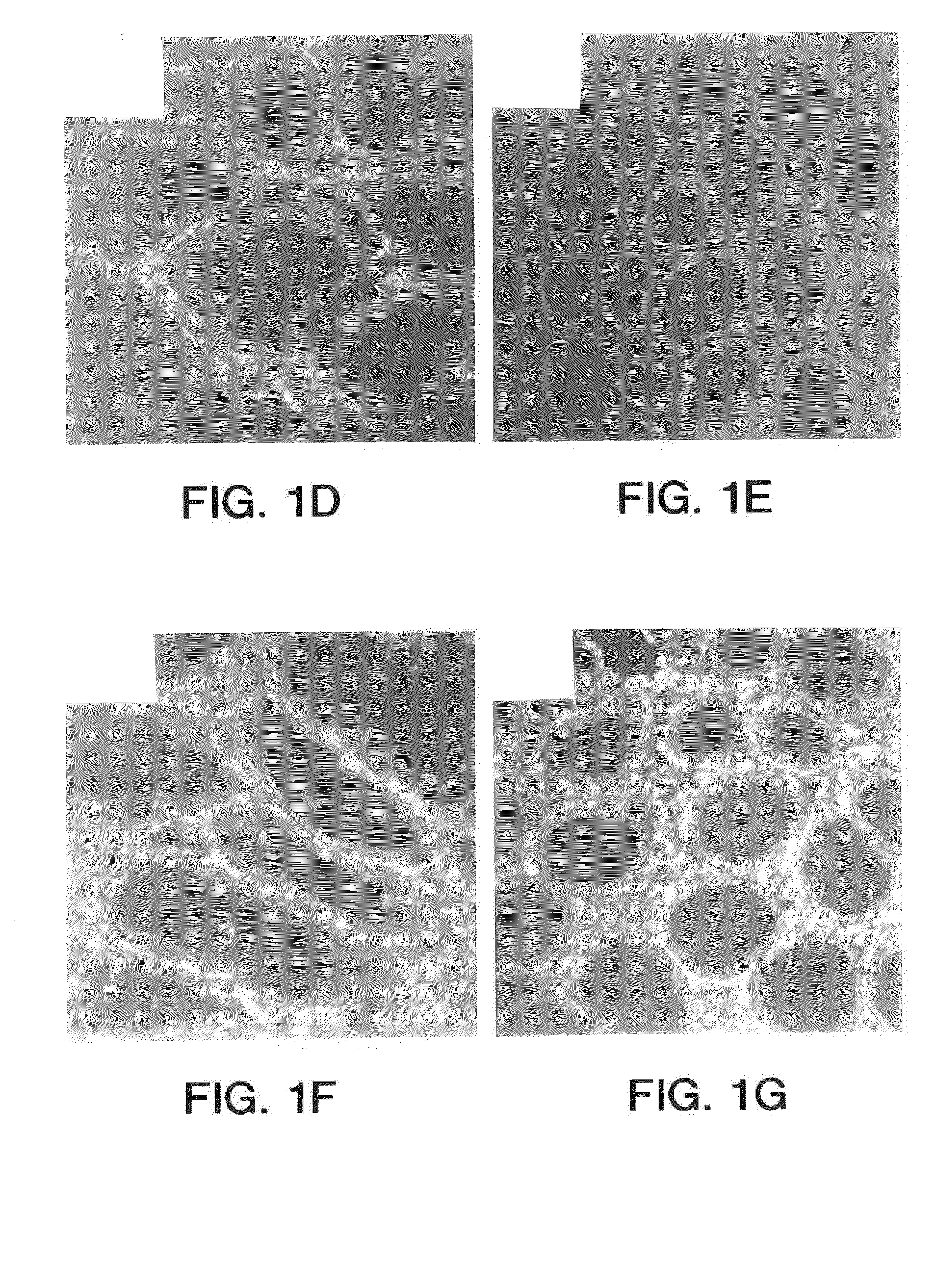 Methods of treatment using wisp polypeptides