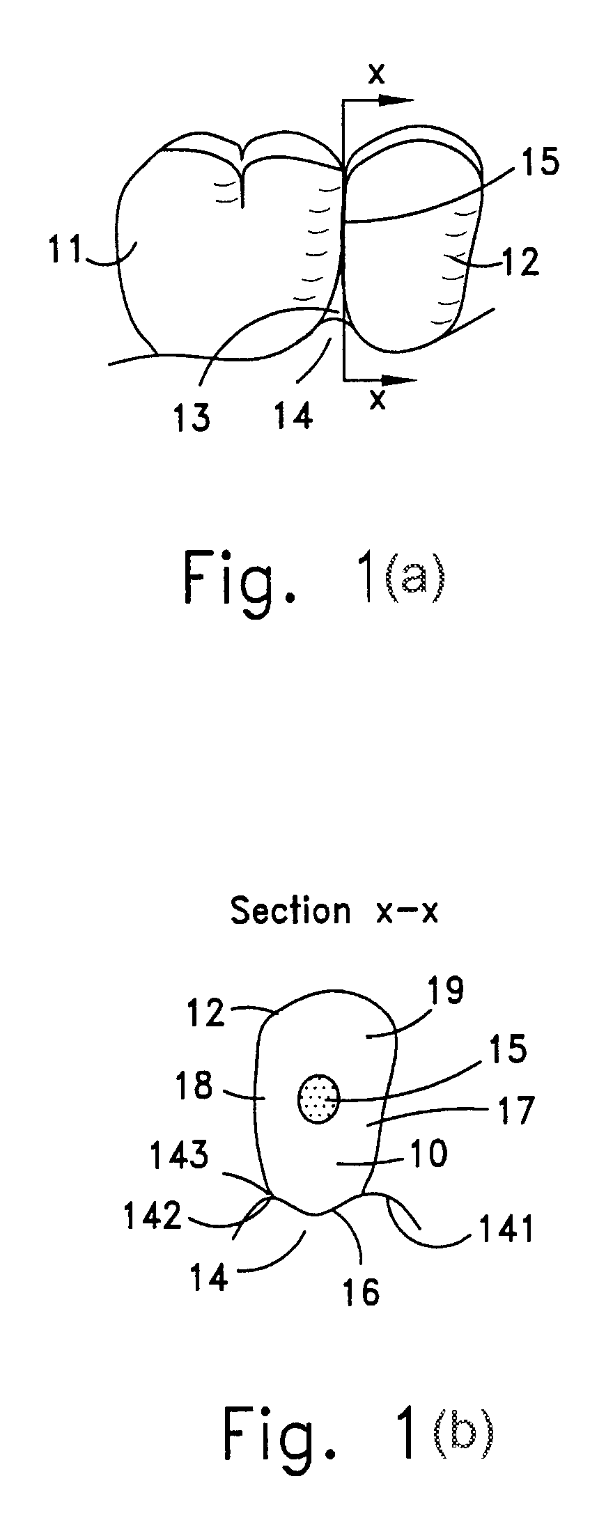 Device for fixation at a dental site