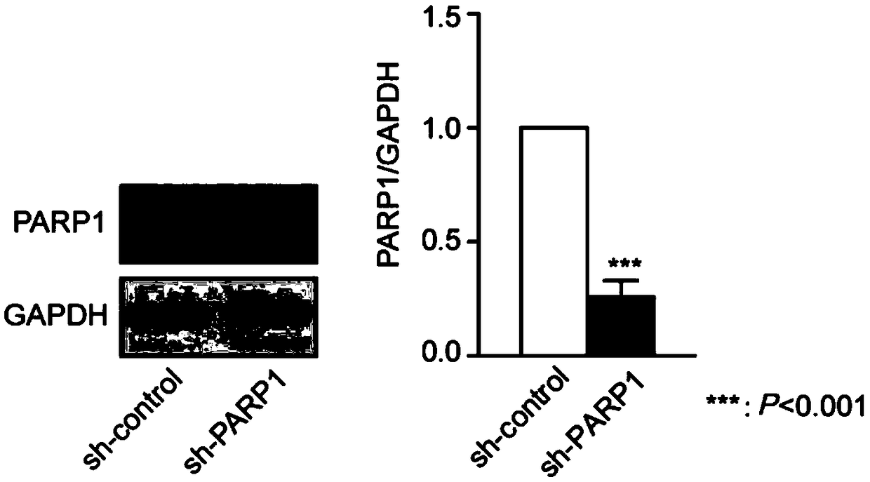 Application of parp1 inhibitor in the preparation of drugs for reversing drug resistance of tumor cells to methotrexate