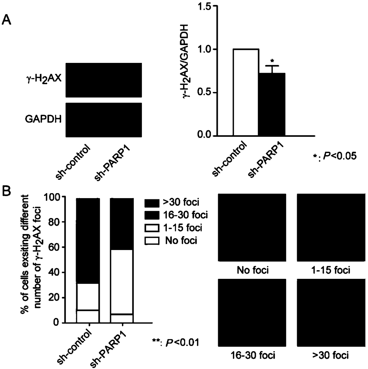 Application of parp1 inhibitor in the preparation of drugs for reversing drug resistance of tumor cells to methotrexate