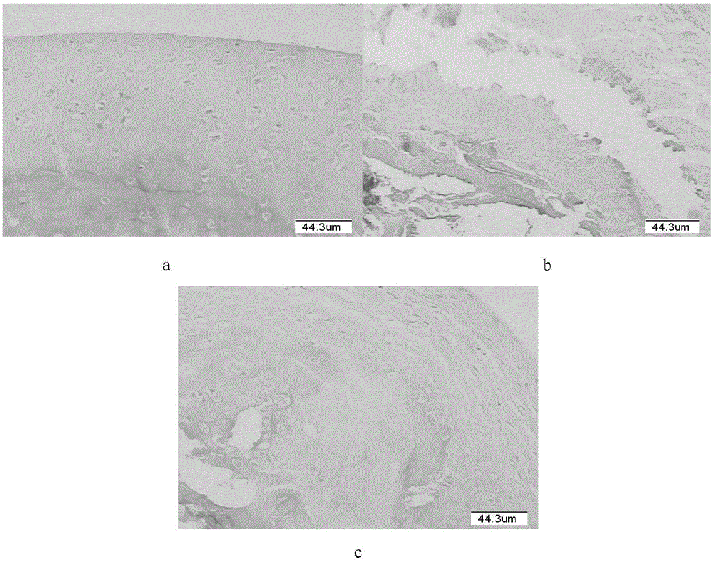 Material of support for treating femoral head necrosis and preparation method thereof