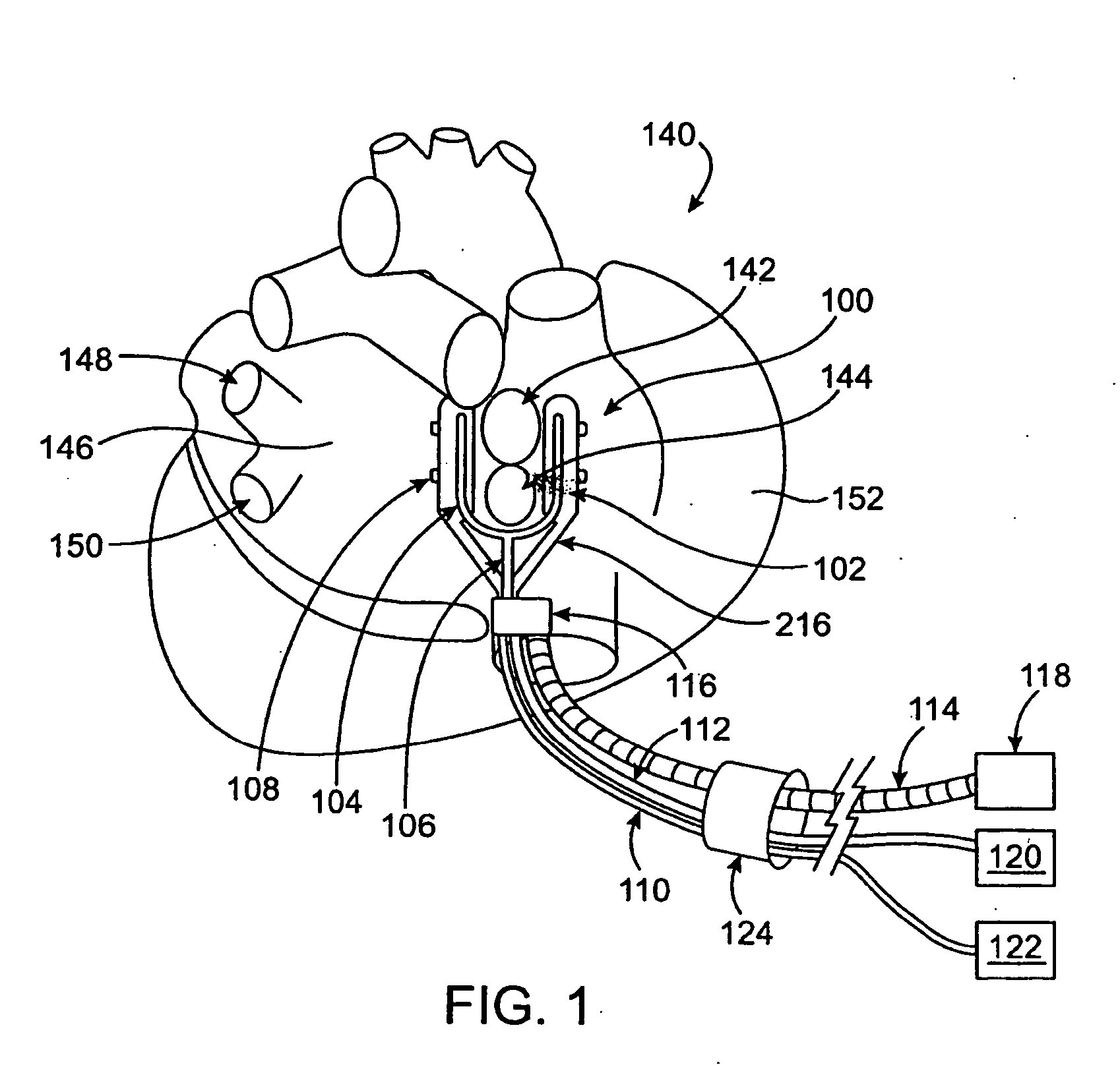 Cardiac treatment devices and methods
