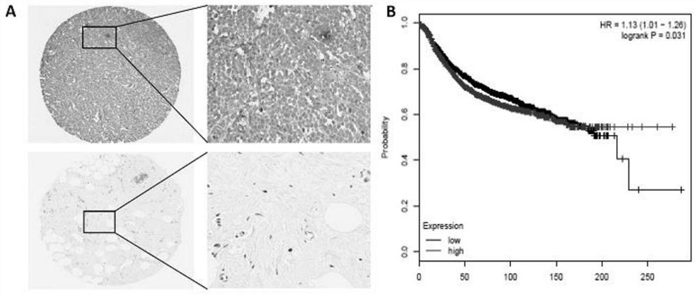 Application of arginine methyltransferase 3 in breast cancer diagnosis and treatment