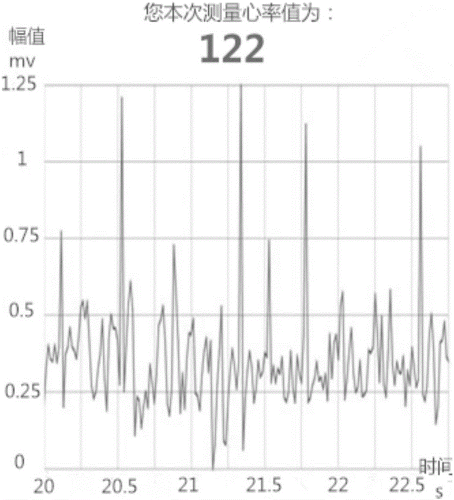 System and method for intelligent video monitoring of vital signs