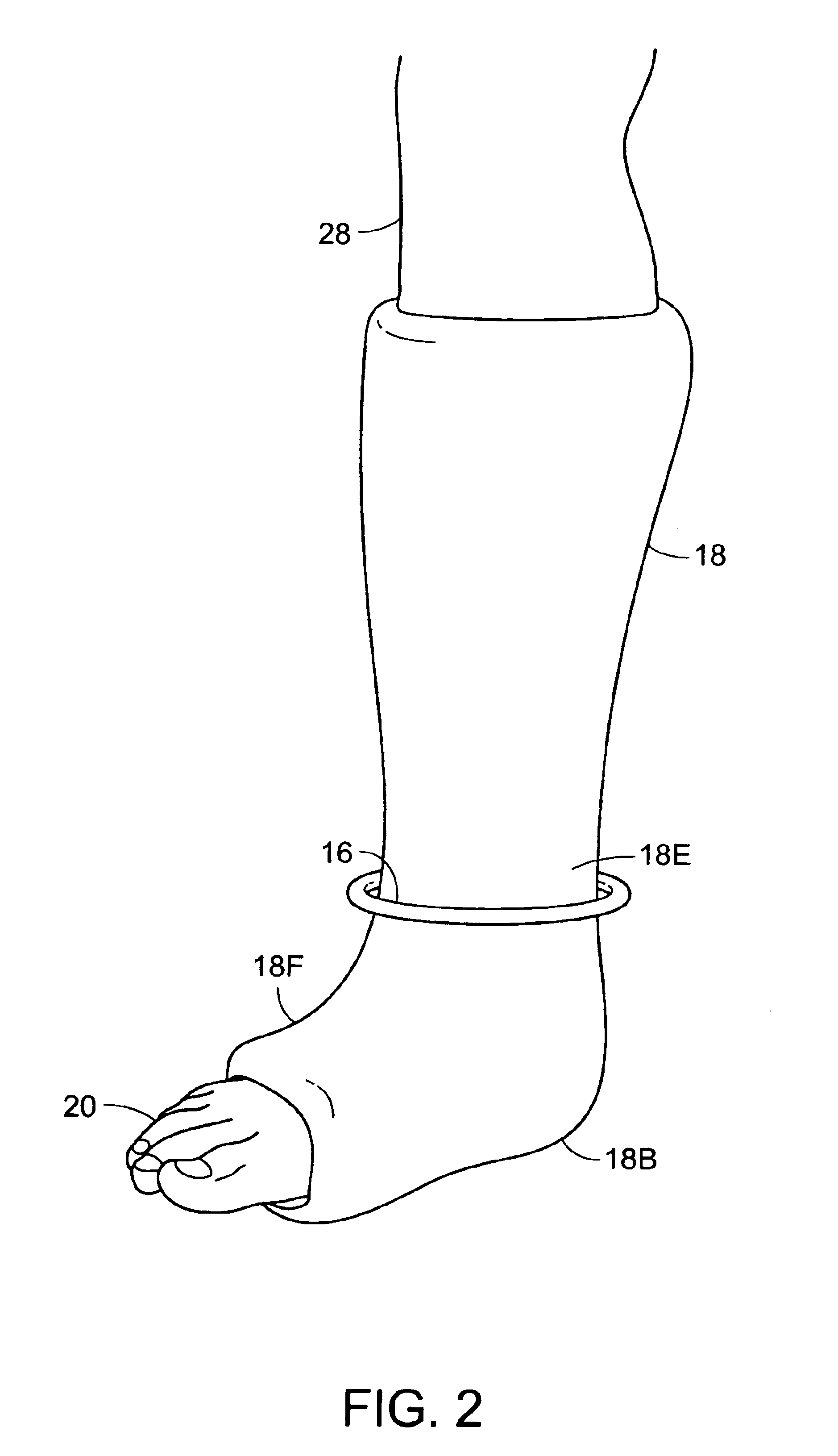 Inflatable support shoe for a foot cast
