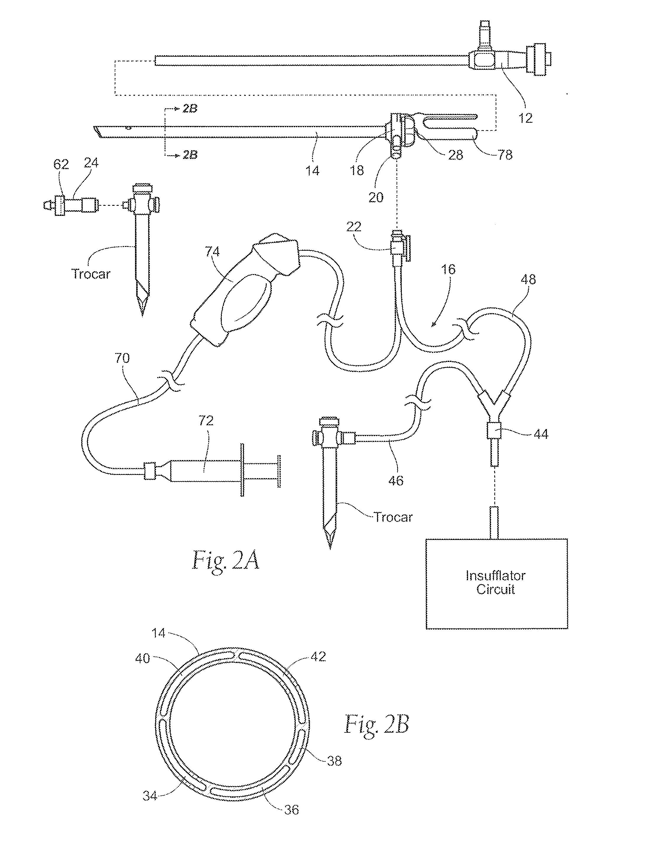 Systems and methods for optimizing and maintaining visualization of a surgical field during the use of surgical scopes