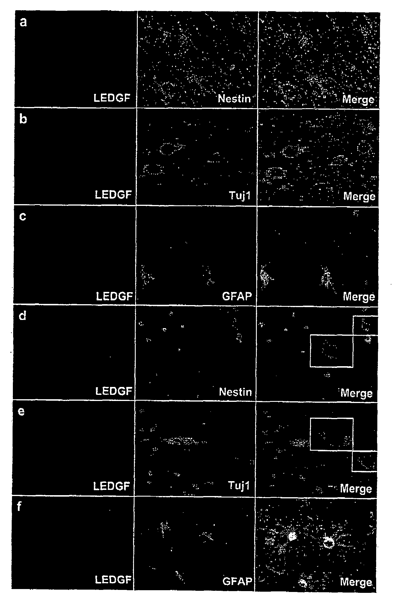 Methods of using LEDGF/p75