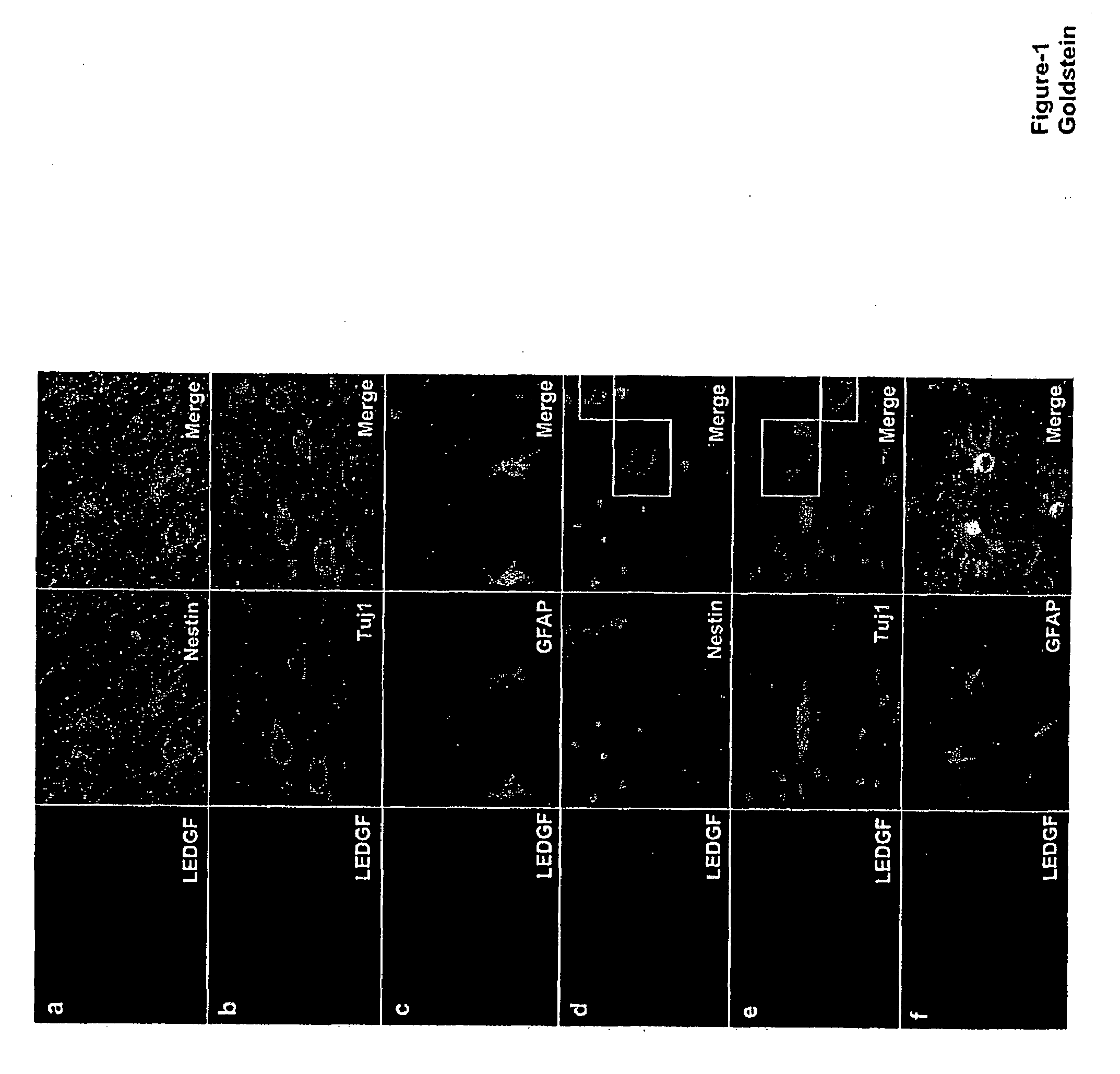 Methods of using LEDGF/p75