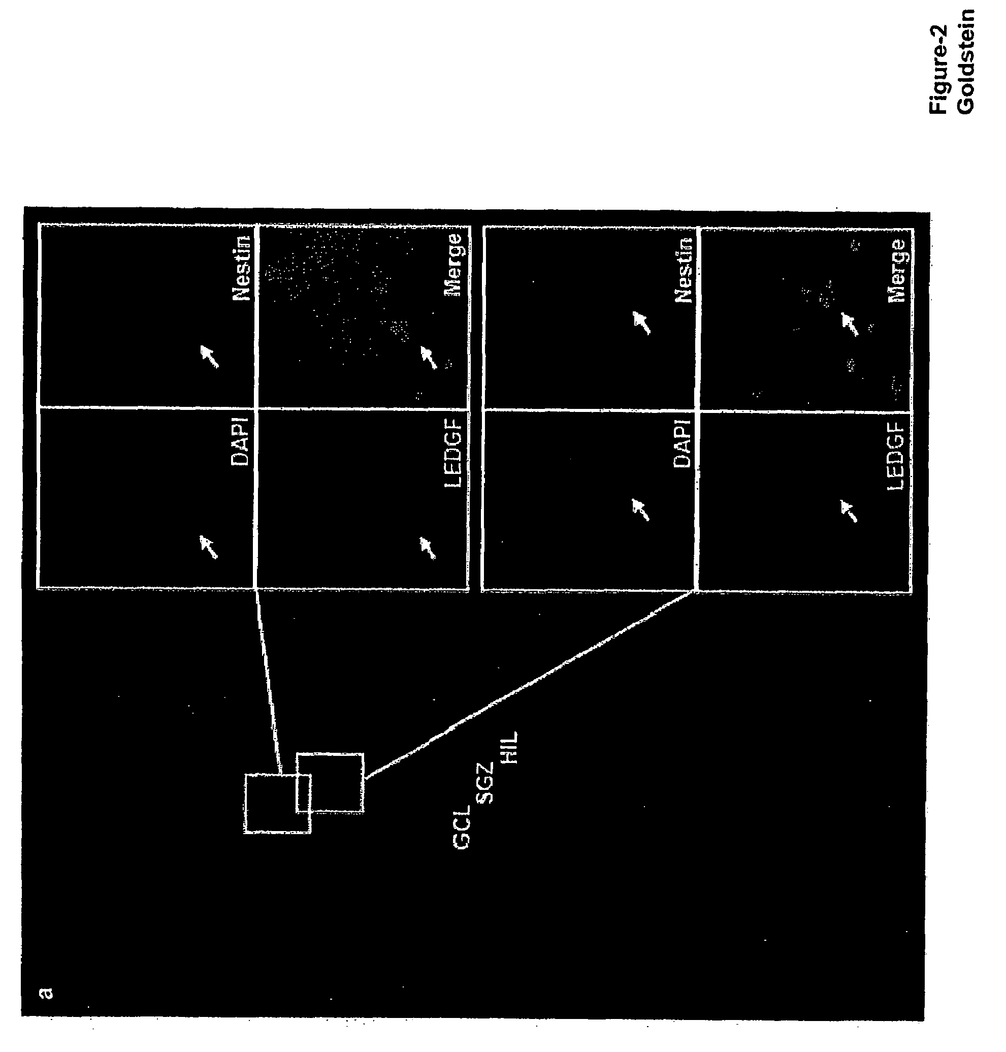 Methods of using LEDGF/p75