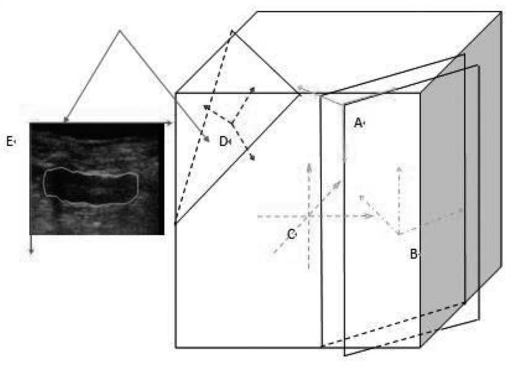 Construction method of static three-dimensional contour image of hifu treatment system