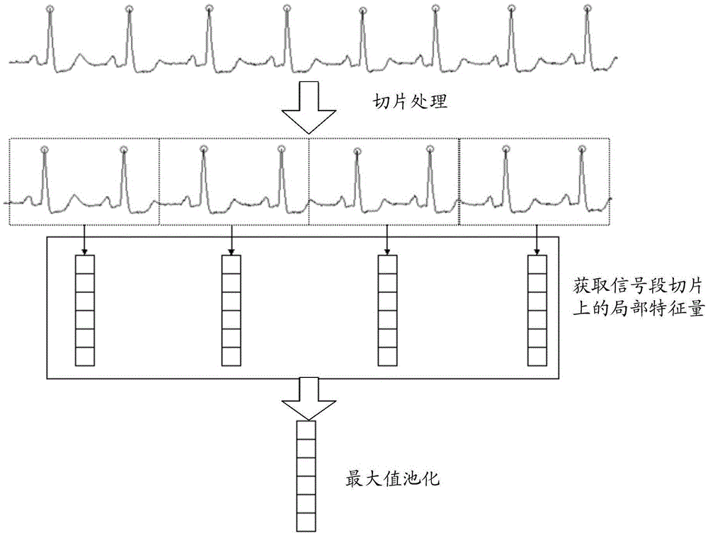 ECG lead intelligent selection method and system