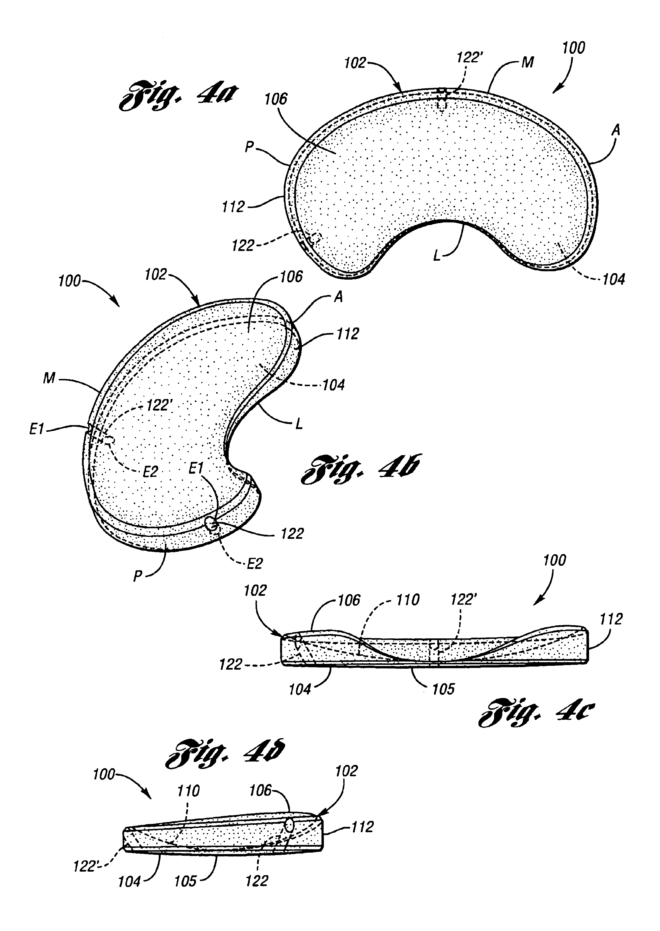 Surgically implantable knee prosthesis having attachment apertures