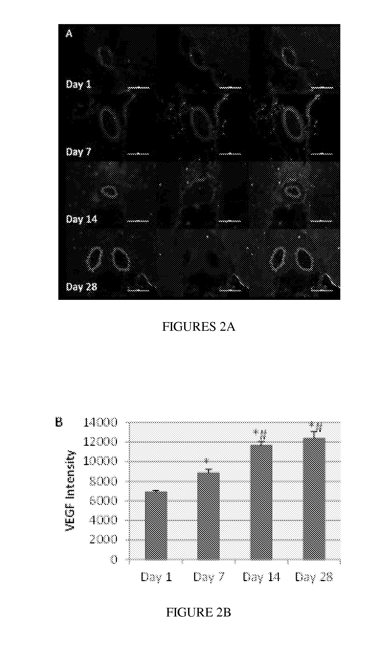 Compositions and Methods for Treating Neuropsychiatric Disorders Using an Endothelin-B Receptor Agonist