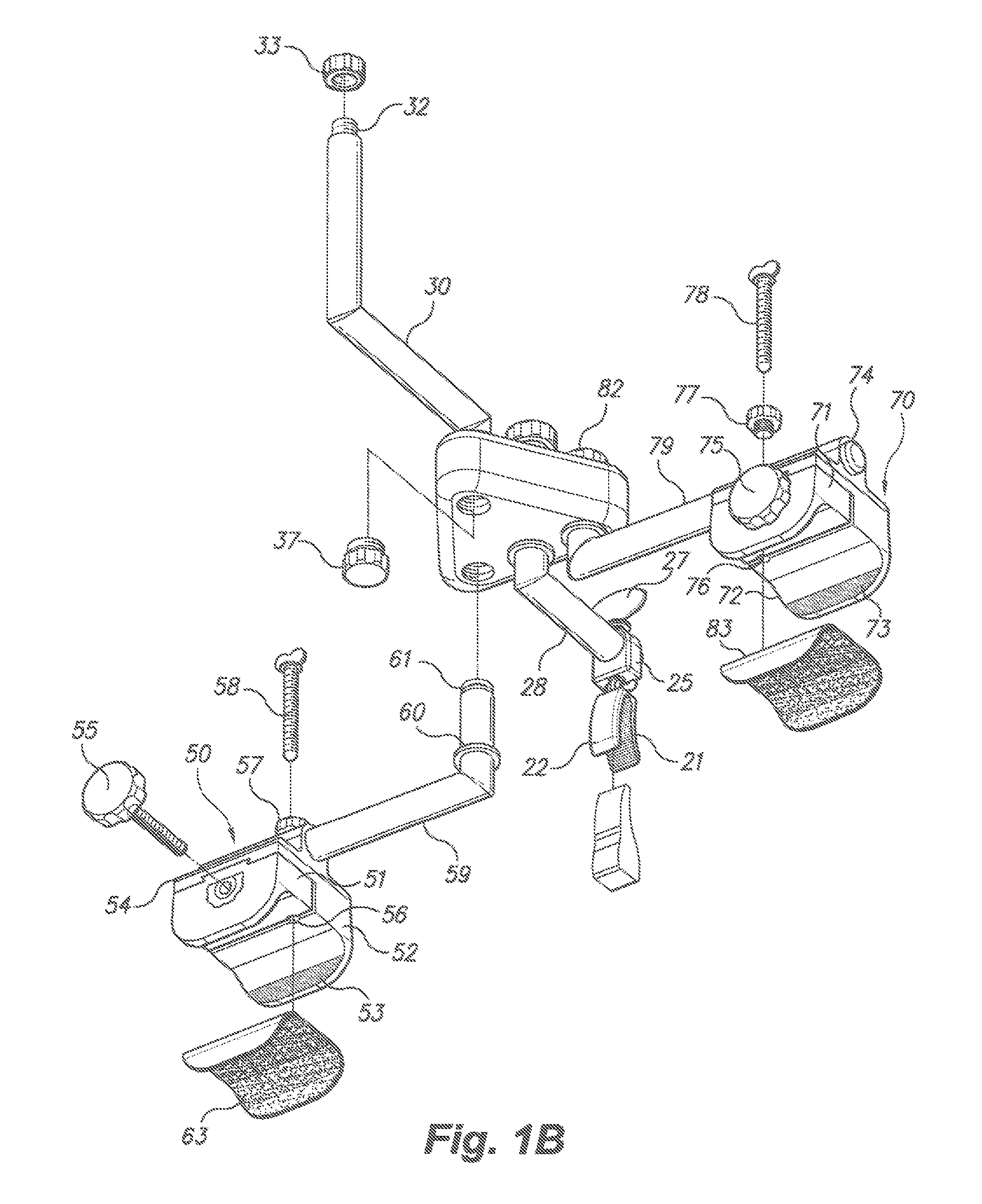 Dental prosthetic and restoration removal system and method