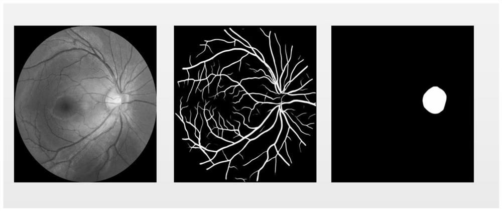 Method for Determining the Tortuosity of Retinal Vessels