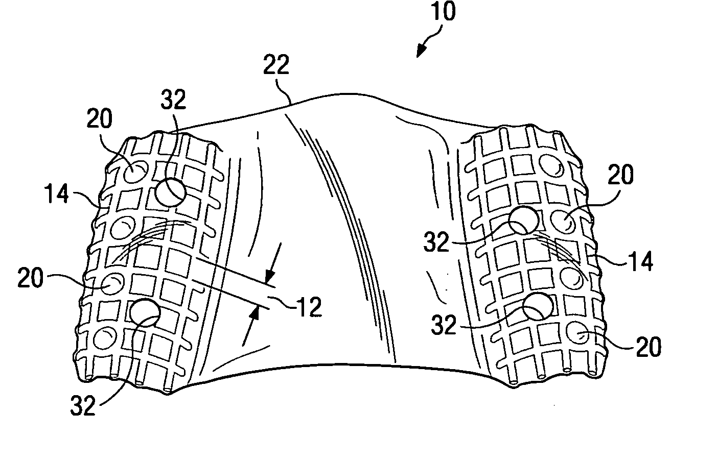 Dental implant placement locator and method of use