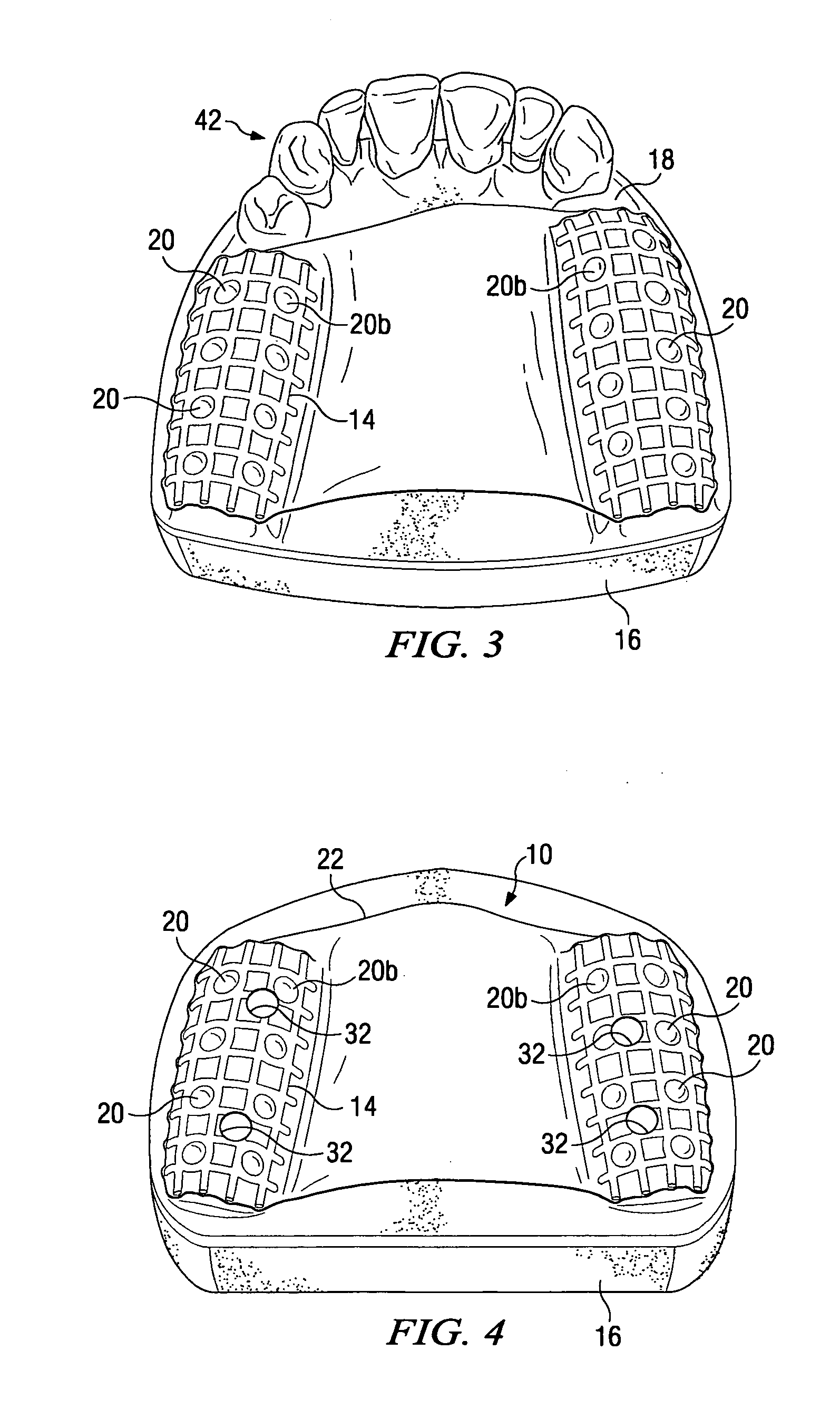 Dental implant placement locator and method of use