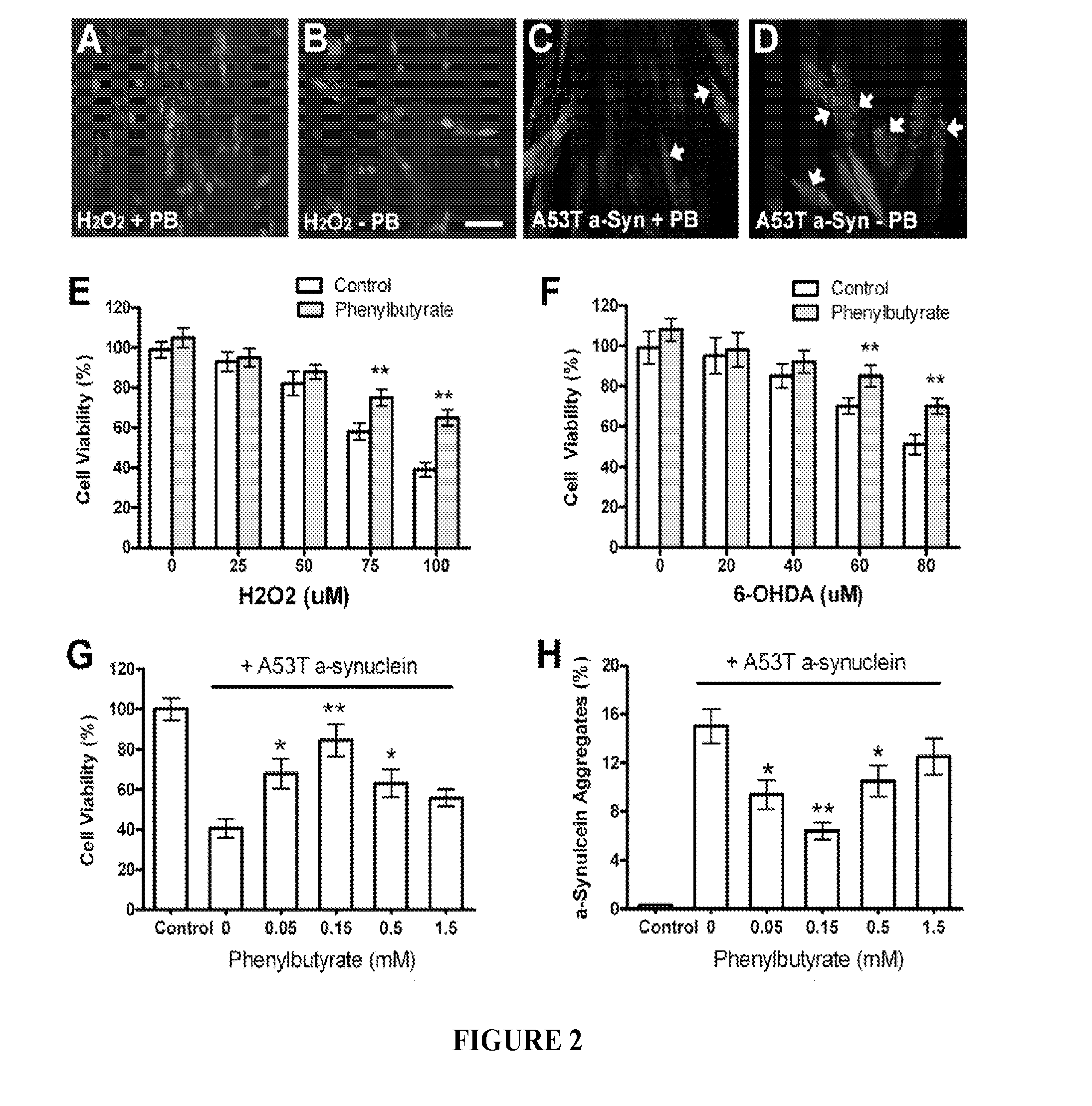 Composition and method for treating neurodegenerative disease