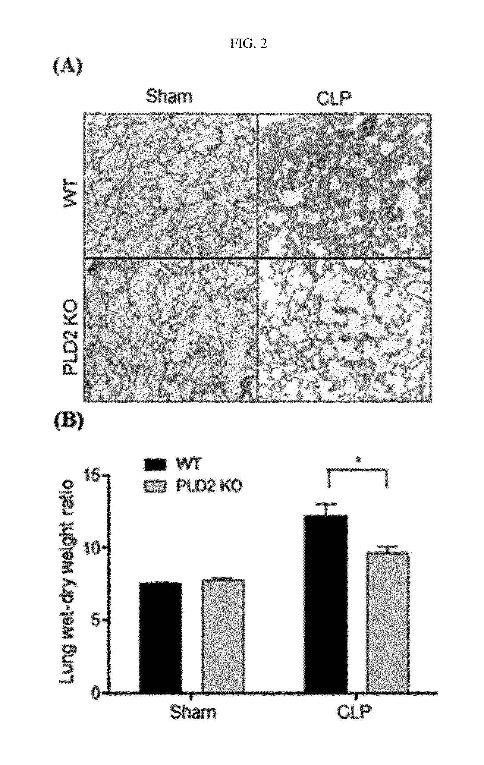 Composition for preventing or treating bacterial infectious disease comprising phospholipase D2 inhibitor