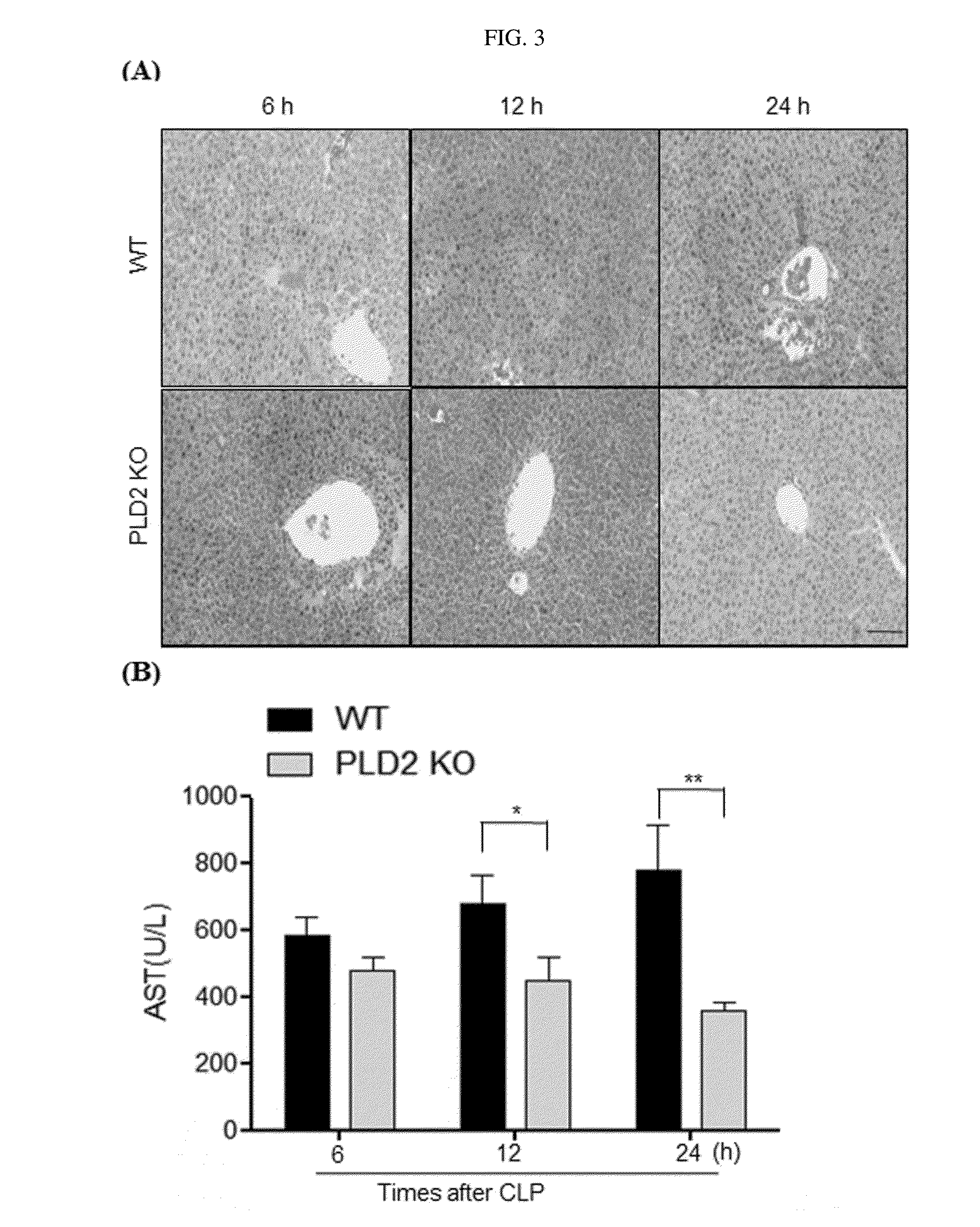Composition for preventing or treating bacterial infectious disease comprising phospholipase D2 inhibitor
