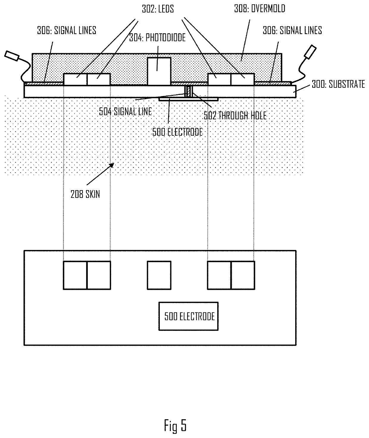 Wearable heart activity sensor device