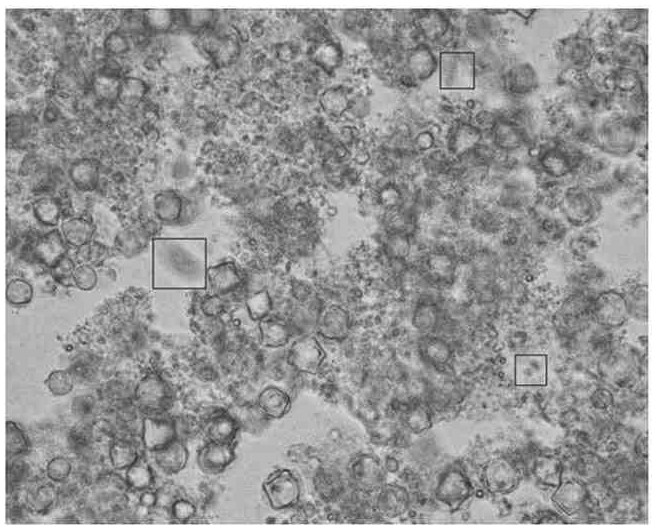 Active biological filter material and sewage high-efficiency nitrogen and phosphorus removal method using the same