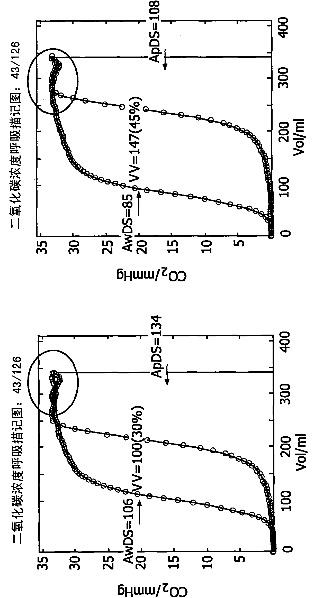 Method and device for evaluation of spirographic and gas exchange data