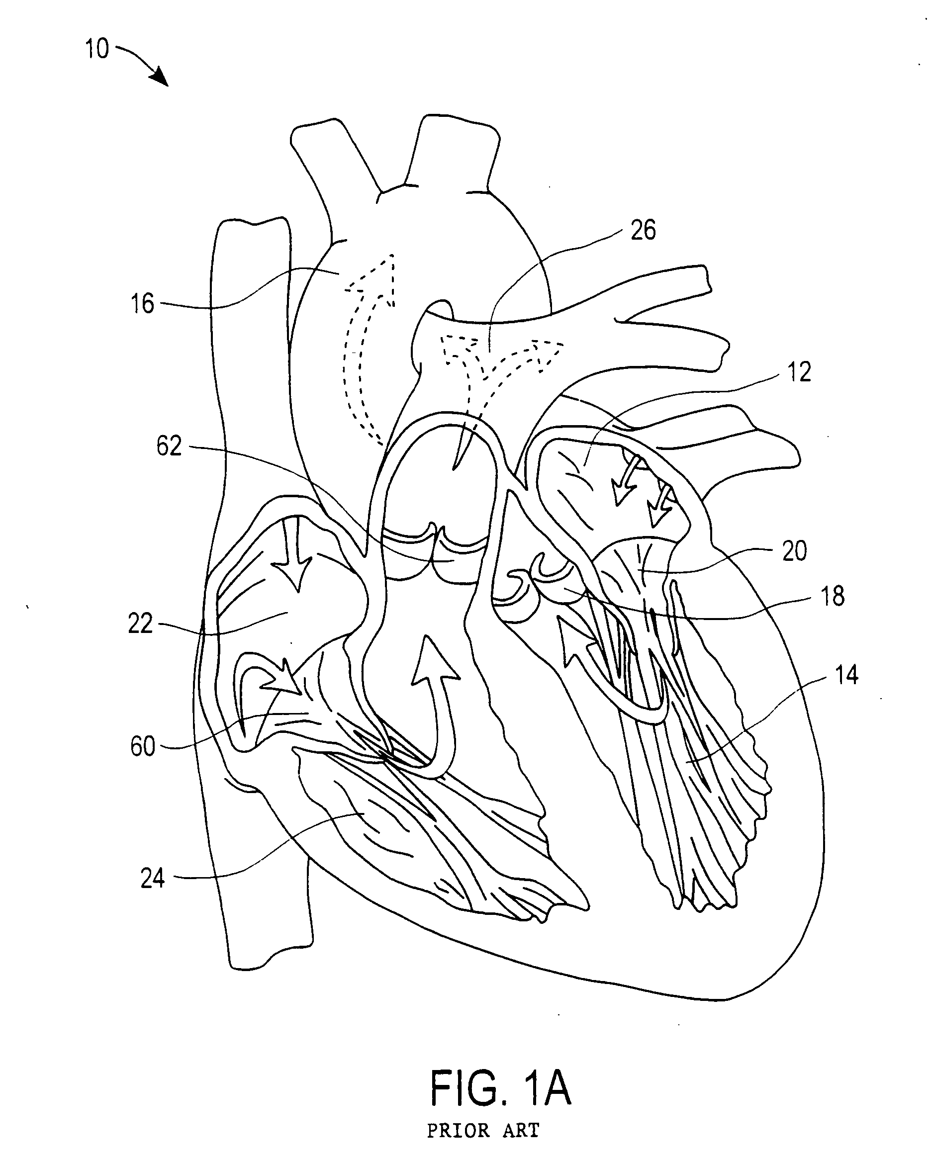 Apparatuses and methods for heart valve repair