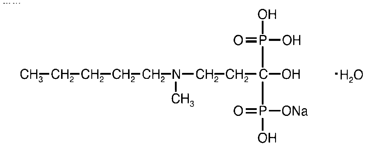 Sodium ibandronate injection composition and preparation method of sodium ibandronate injection composition