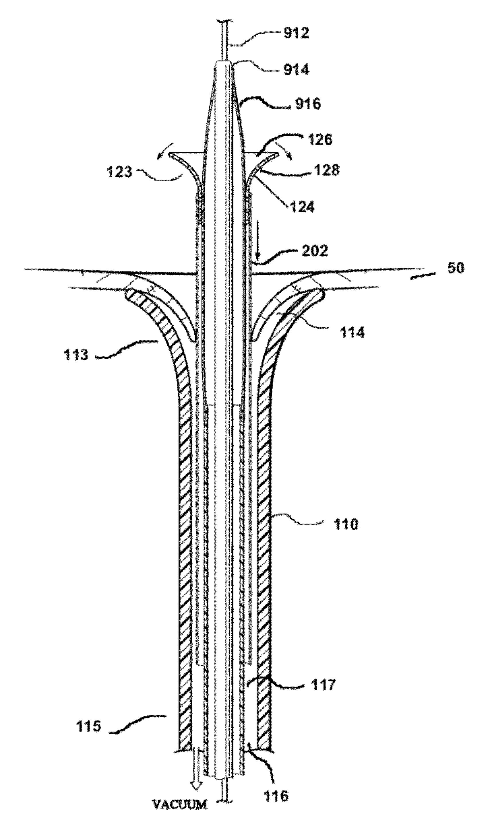Cannula Systems and Methods