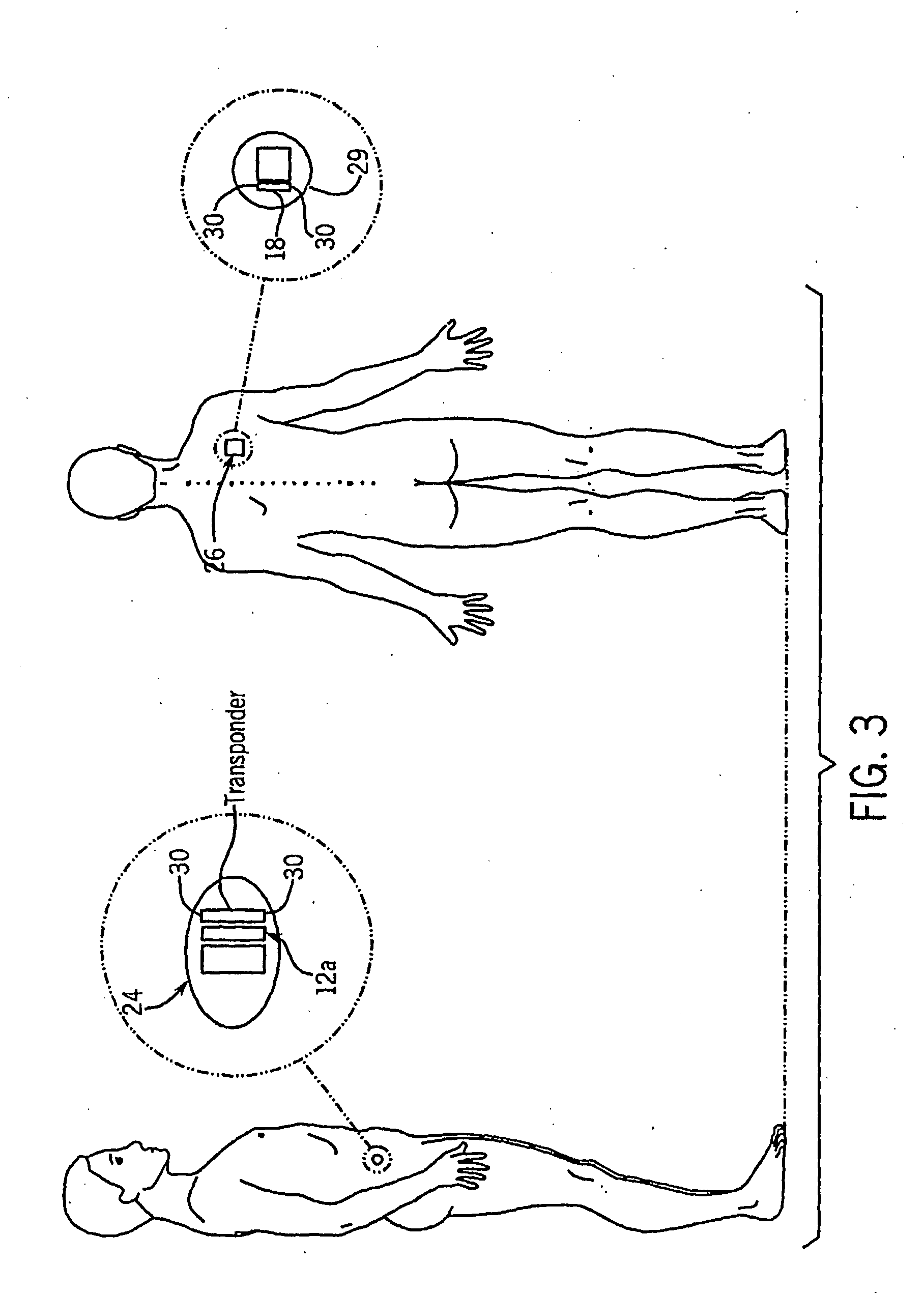 System for Monitoring a Physical Parameter of a Subject