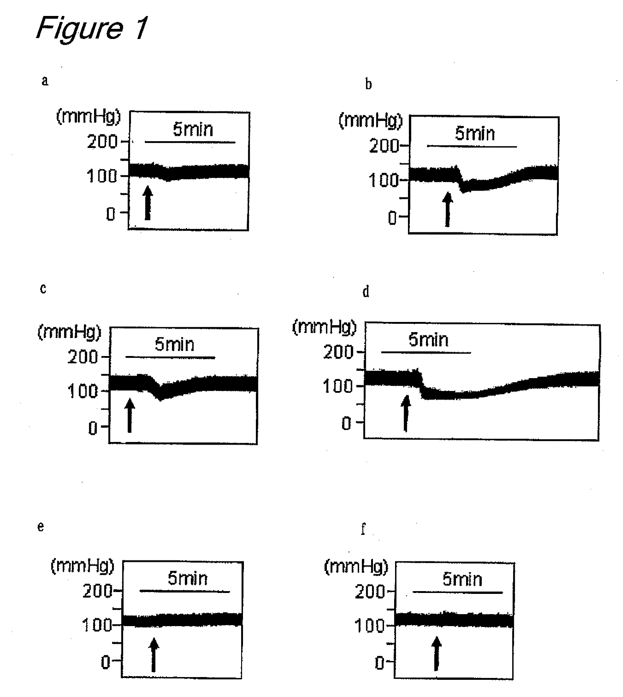 Peptide having hypotensive activity