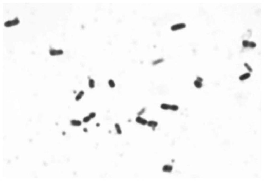 A strain of Acetobacter pasteurianus subsp. pasteurianum, microbial agent and its application