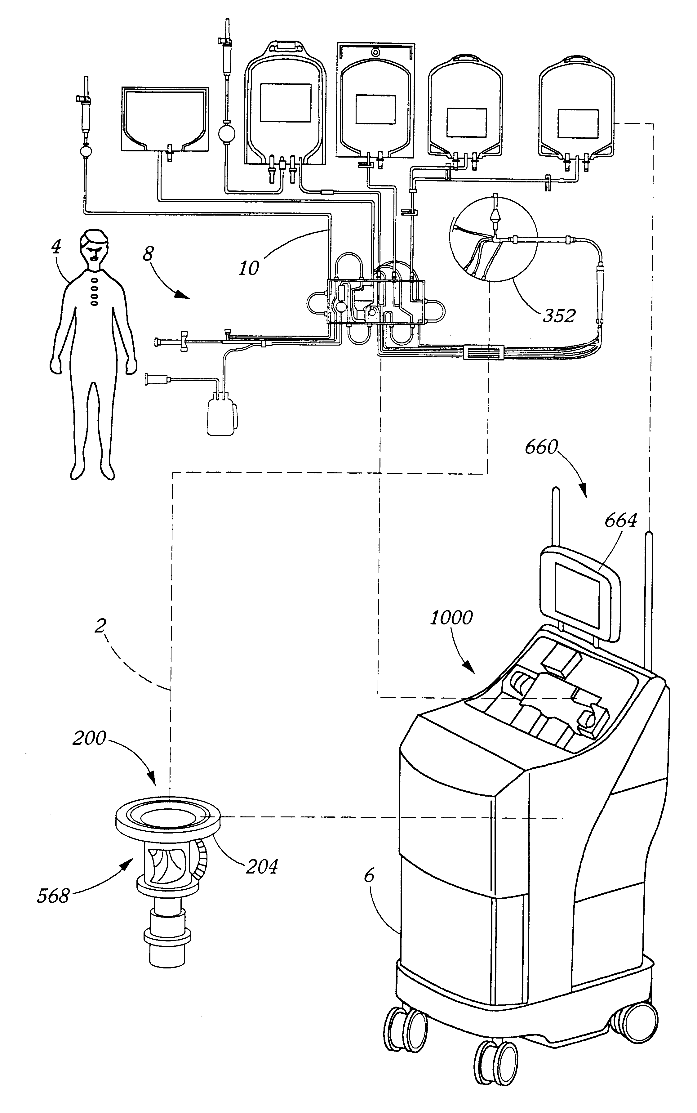 Extracorporeal blood processing methods and apparatus