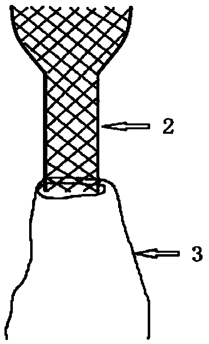 Safety device and method for preventing heart implanting device from shedding and application thereof