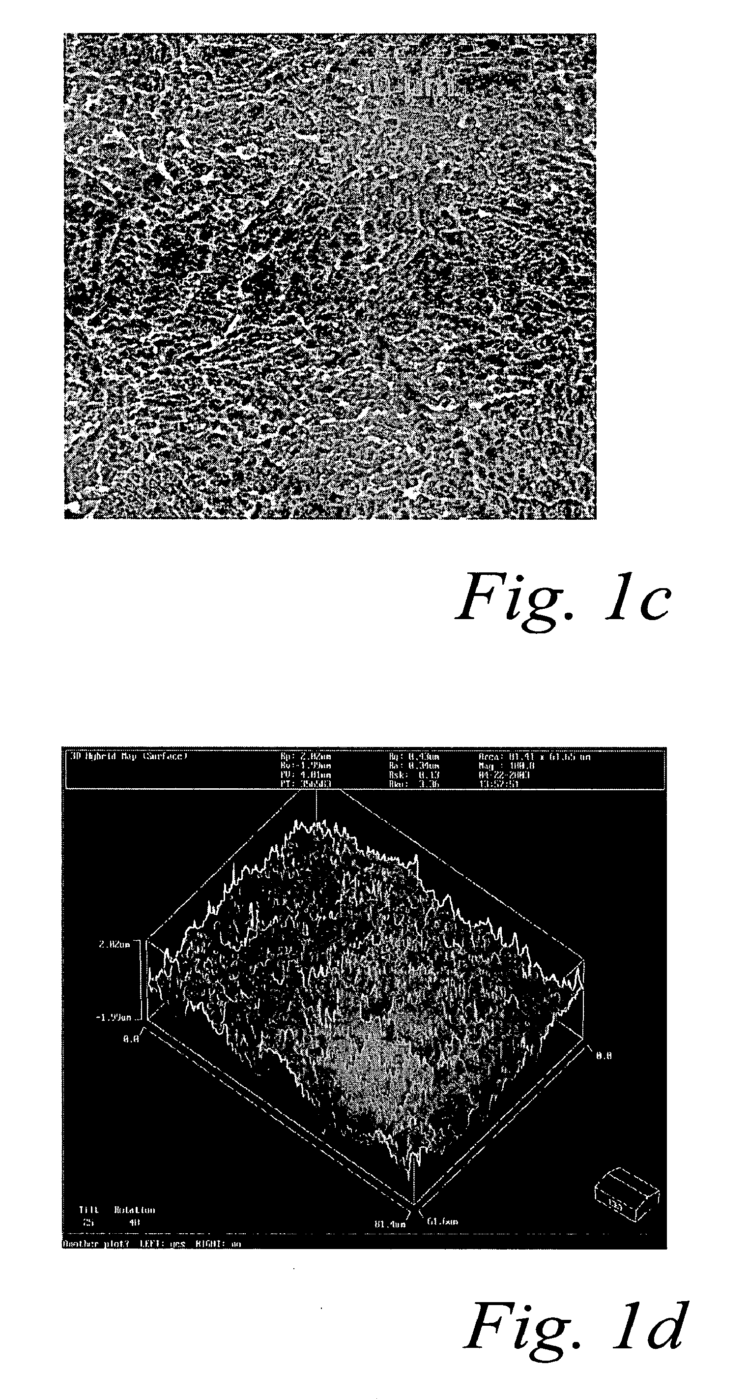 Surface treatment process for implants made of titanium alloy