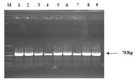 Soybean MYB (v-myb avian myeloblastosis viral oncogene homolog) transcription factor as well as coding gene and application thereof