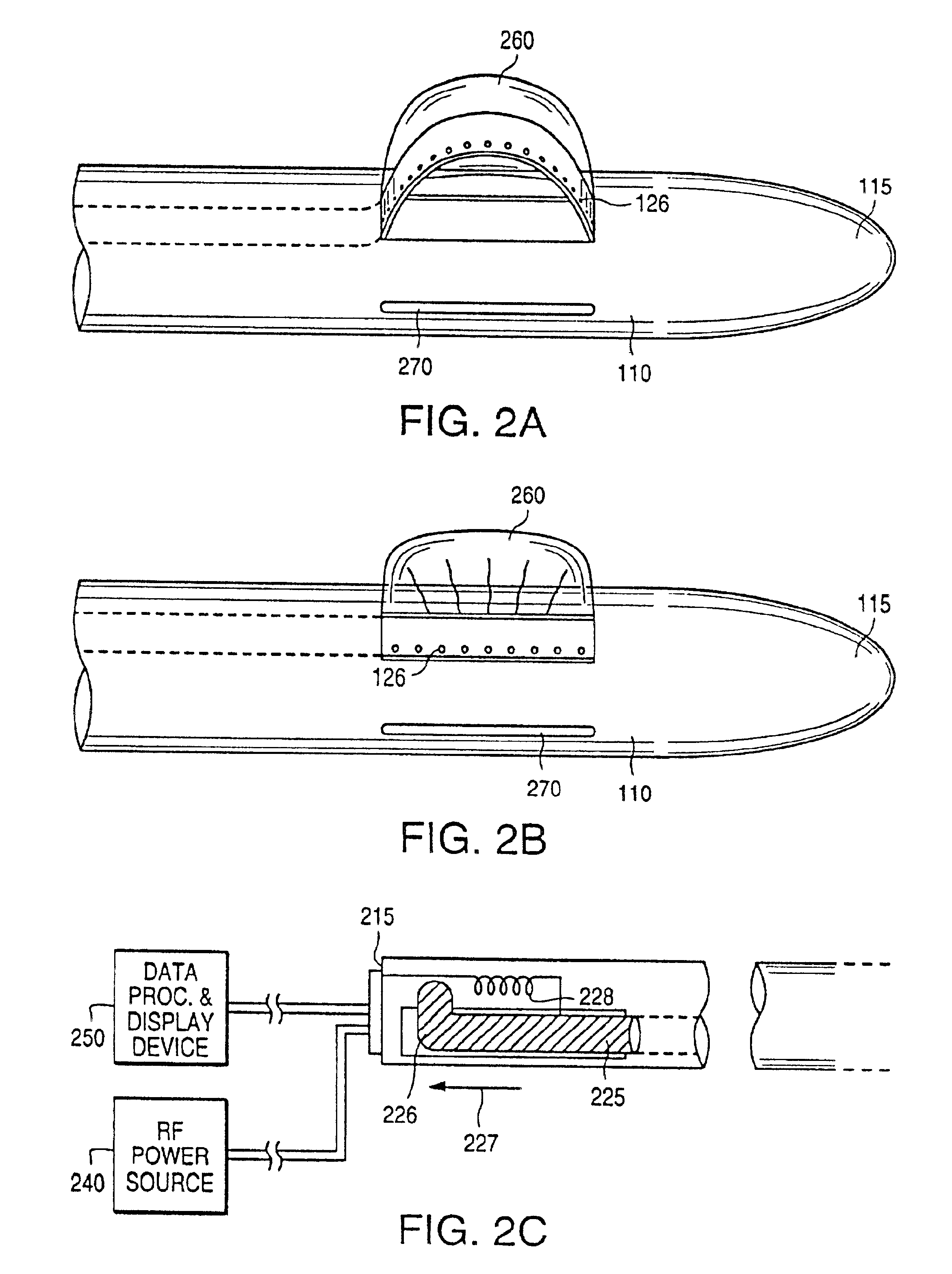 Excisional biopsy devices and methods
