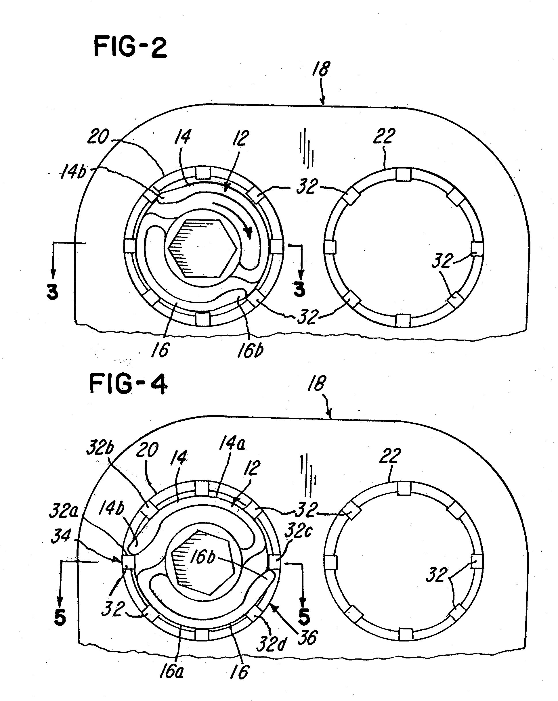 Implant plate screw locking system and screw having a locking member