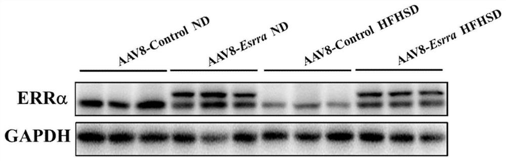 Medical application of encoding gene ESRRA of estrogen-related receptor alpha (ERR alpha)