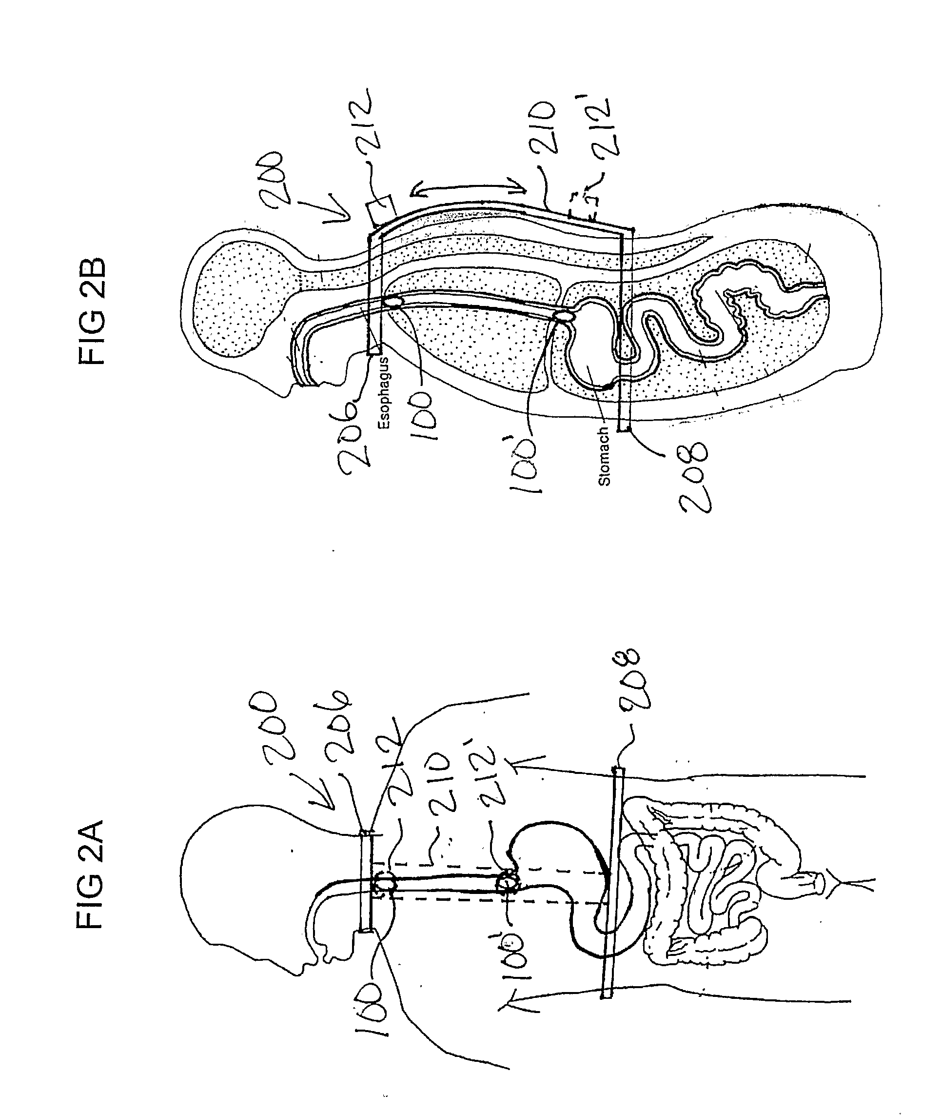 Apparatus and Methods for Capsule Endoscopy of the Esophagus